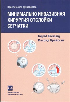 Уценка. Минимально инвазивная хирургия отслойки сетчатки. Практическое руководство (Крейсиг) 2892 - фото 5988