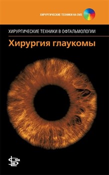 Уценка. Хирургия глаукомы (некондиция) 2958 - фото 6090