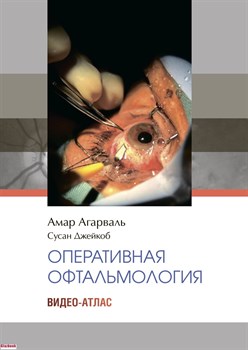 Оперативная офтальмология. Видео-атлас. (1-3 диски) - фото 6471
