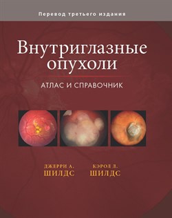 Уценка. Внутриглазные опухоли. Атлас и справочник Том3. (некондиция) 3141 - фото 6479