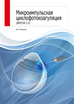 Микроимпульсная циклофотокоагуляция 2.0 (Иошин) 3337 - фото 7033