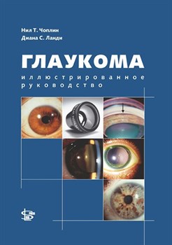 Уценка. Глаукома. Иллюстрированное руководство (Чоплин) -некондиция 3340 - фото 7040