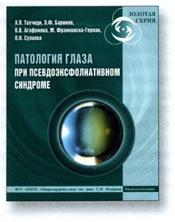 Патология глаза при псевдоэксфолиативном синдроме 3404 - фото 7257