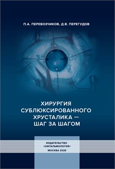 Хирургия сублюксированного хрусталика — шаг за шагом 3472