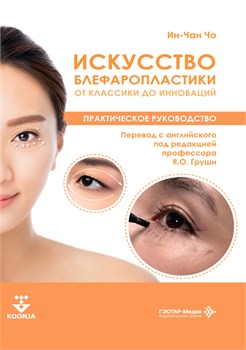 Искусство блефаропластики. От классики до инноваций 3485