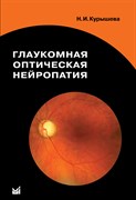 Глаукомная оптическая нейропатия