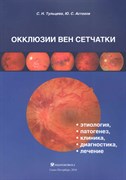 Окклюзии вен сетчатки (этиология, патогенез, клиника, диагностика, лечение)