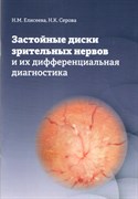 Застойные диски зрительных нервов и их дифференциальная диагностика (Елисеева)