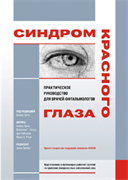 Синдром красного глаза. Практическое руководство для врачей-офтальмологов